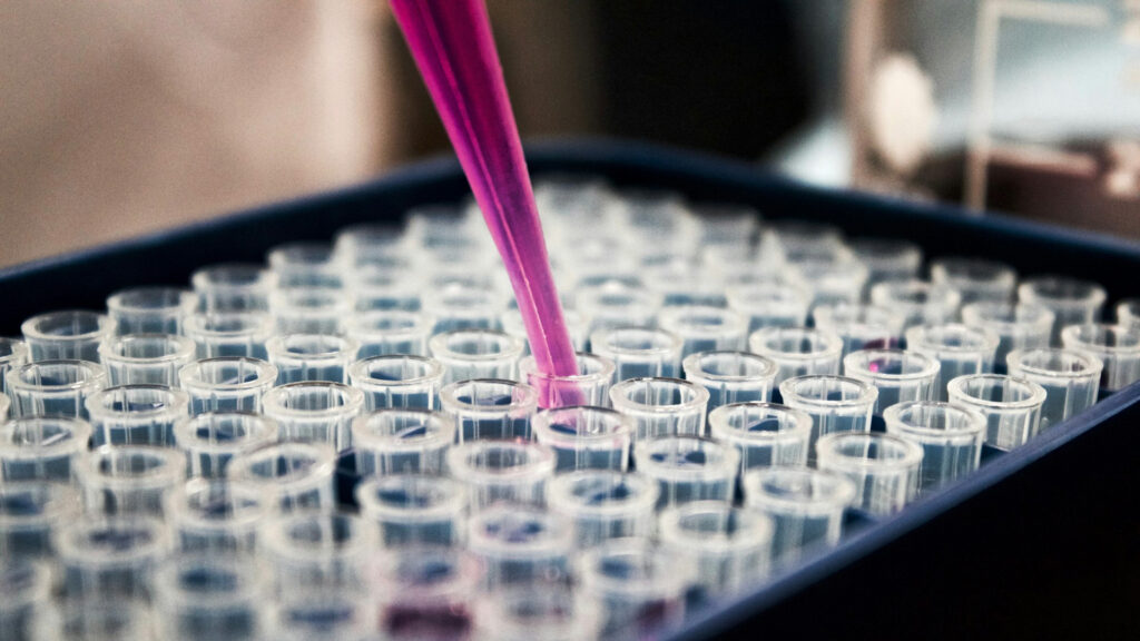 Pipette filling test tubes Pipette filling test tubes