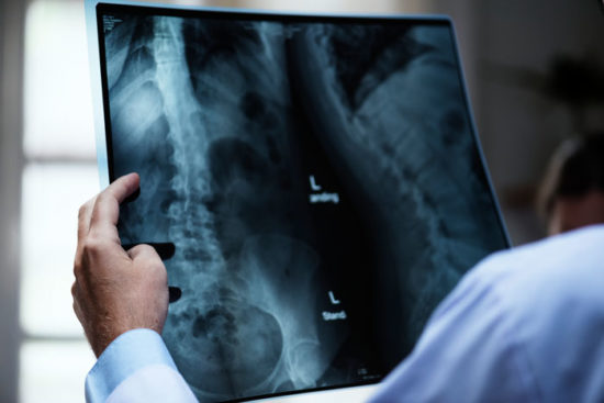 Physician looking at x-ray