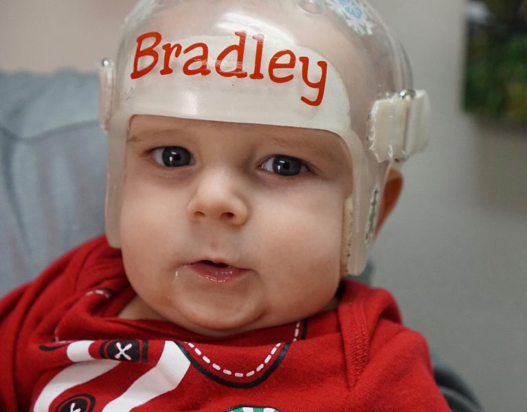 Patient Bradley wearing a cranial remolding helmet and smiling.