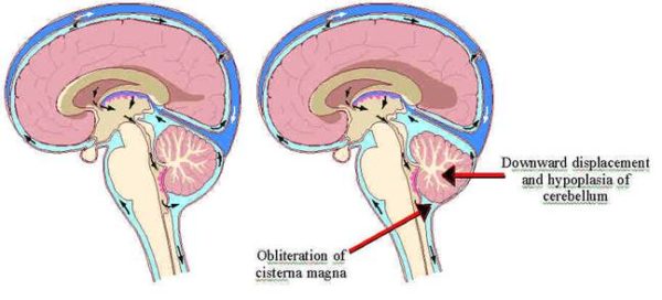 Medical diagram illustrating parts of the brain.