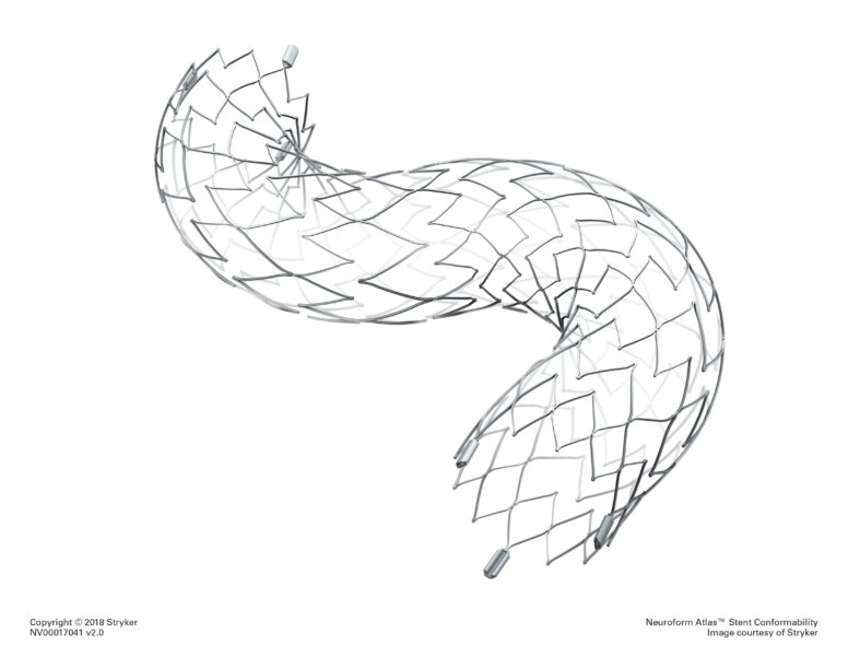 Stent diagram. It looks like a serpentine curve of wired mesh.