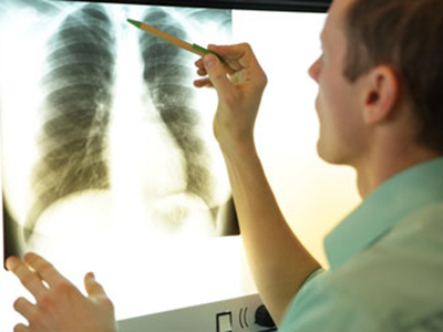 Medical student reading a chest x-ray iamge